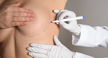 Mamoplastia Pos-Operatorio_D